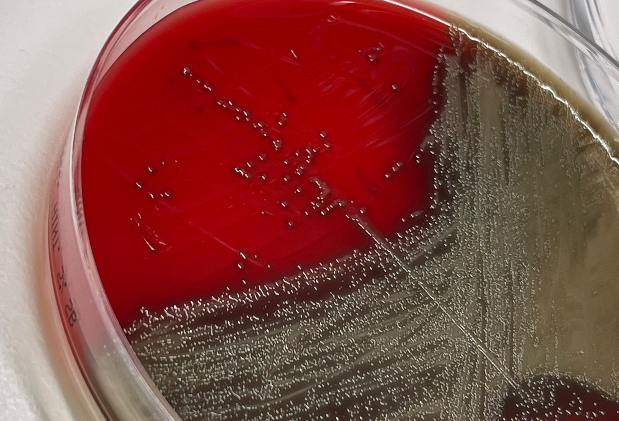Cultivo en laboratorio de 'Streptococcus pneumoniae'.